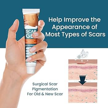 Sumifun Silicone Scar Gel - 30g - Image 3