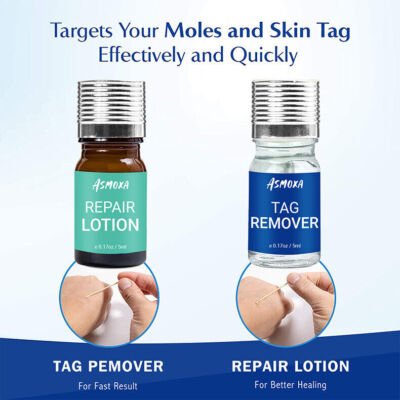 Asmoxa Skin Tag Mole & Wart Remover - Image 2